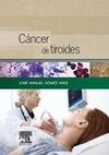 CÁNCER DE TIROIDES