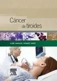 Cáncer de Tiroides