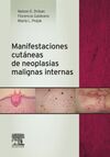 MANIFESTACIONES CUTÁNEAS DE NEOPLASIAS MALIGNAS INTERNAS