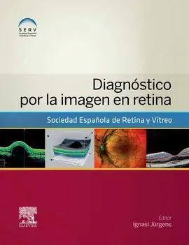 Diagnóstico por la Imagen en Retina