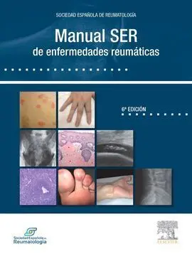 Manual Ser de Enfermedades Reumaticas