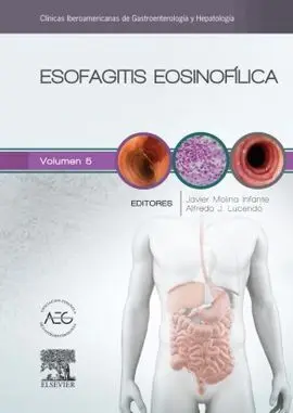 Esofagitis Eosinofílica