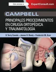 Campbell. Principales Procedimientos en Cirugía Ortopédica y Traumatología + Exp
