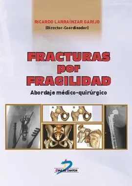 Fracturas por Fragilidad