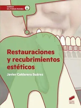 Restauraciones y Recubrimientos Esteticos