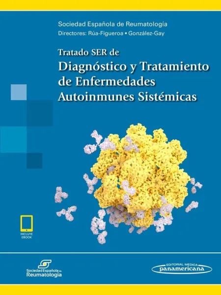 Tratado Ser de Diagnóstico y Tratamiento de Enfermedades Autoinmunes Sistémicas