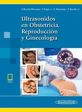 Ultrasonidos en Obstetricia Reproduccion y Ginecologia
