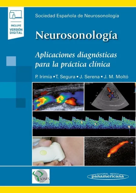 Neurosonología (Incluye Ebook)