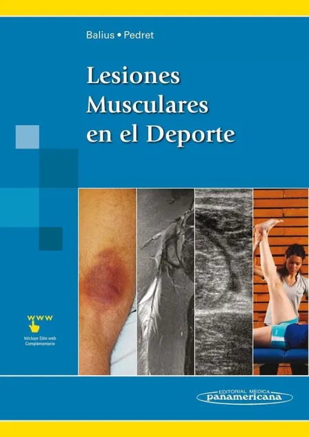 Balius:lesiones Musculares en el Deporte