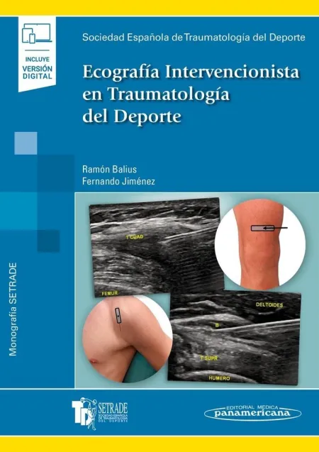 Ecografía Intervencionista en Traumatología del Deporte