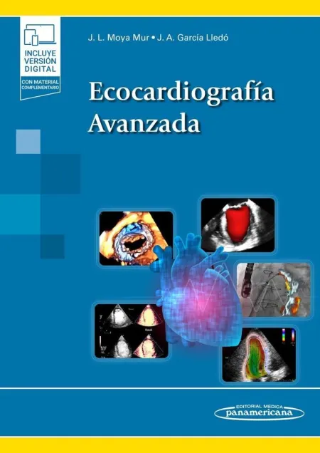 Ecocardiografía Avanzada + E-Book