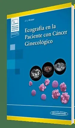 Ecografía en la Paciente con Cáncer Ginecológico (+ E-Book)