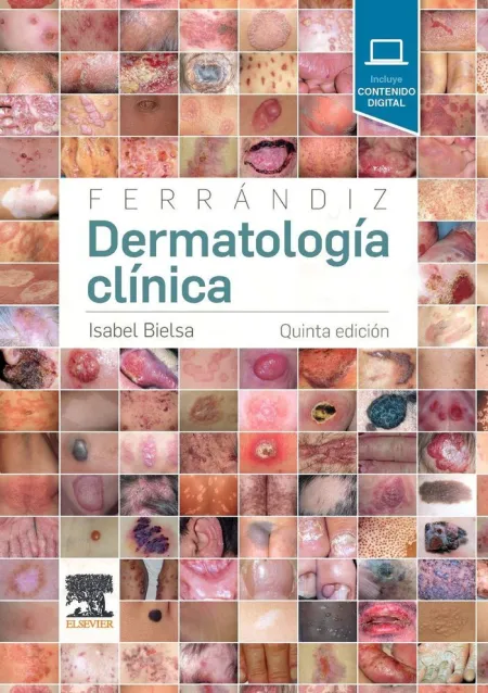 Ferrándiz. Dermatología Clínica (5ª Ed. )