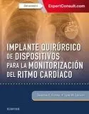 Implante Quir£Rgico de Dispositivos para la Monitorizaci¢N del Ritmo Card¡Aco +