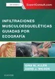Infiltraciones Musculoesqueléticas Guiadas por Ecografía