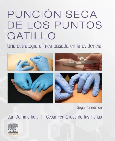 Punción Seca de los Puntos Gatillo (2ª Ed. )