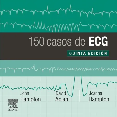 150 Casos de Ecg