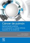 CÁNCER DE PULMÓN