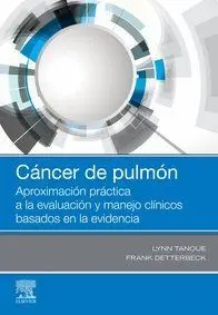 Cáncer de Pulmón