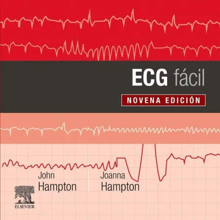 Ecg Facil