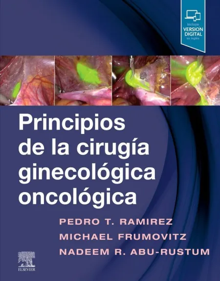 Principios de la Cirugía Ginecológica Oncológica