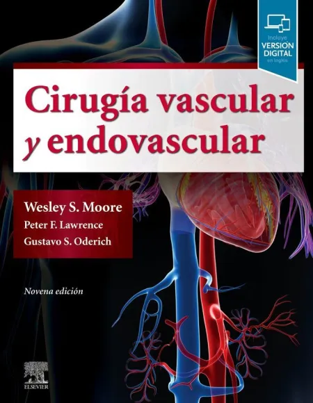 Cirugia Vascular y Endovascular