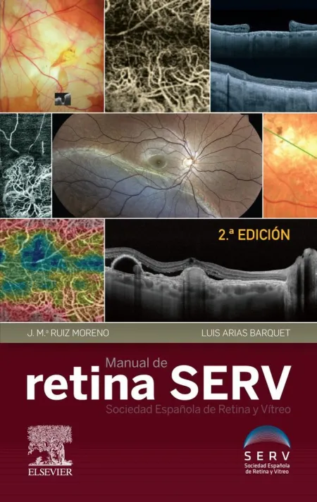 Manual de Retina Serv (2ª Ed. )