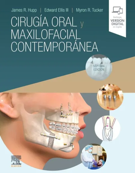 Cirugia Oral y Maxilofacial Contemporanea 7ªed 20