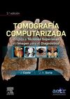 TOMOGRAFÍA COMPUTARIZADA DIRIGIDA A TÉCNICOS SUPERIORES EN IMAGEN PARA EL DIAGNÓ