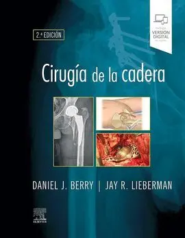 Cirugia de la Cadera 2ª Ed