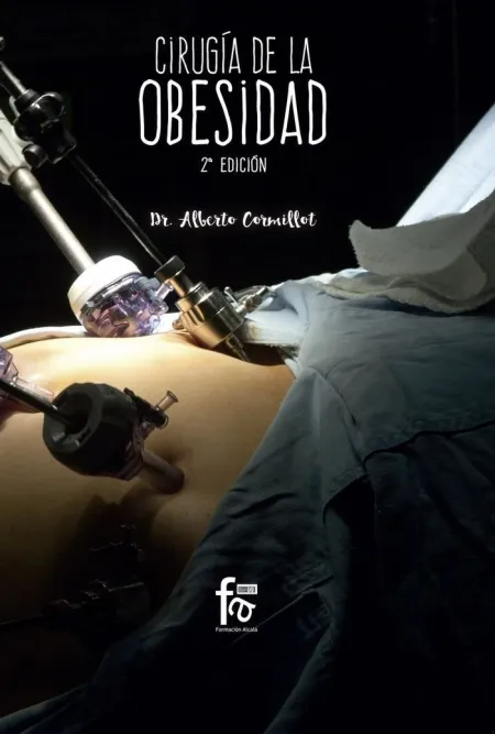 Cirugia de la Obesidad-2 Edicion