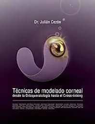 Técnicas de Modelado Corneal