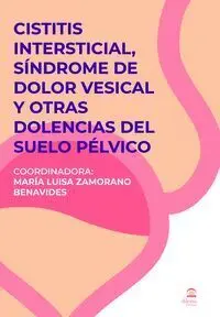Cistitis Intersticial, Síndrome del Dolor Vesical