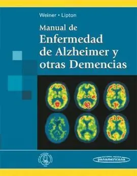 Manual de Enfermedad de Alzheimer y Otras Demencias