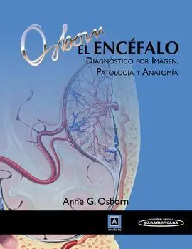 El Encéfalo