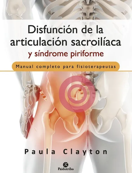 Disfunción de la Articulación Sacroilíaca y sín