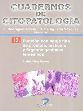 Puncion con Aguja Fina de Prostata...