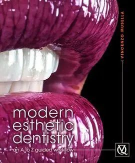 Modern Esthetic Dentistry. An a To Z Guided Workflow