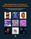 WHO CLASSIFICATION OF TUMOURS OF HAEMATOPOIETIC AND LYMPHOID TISSUES. 4ª ED.