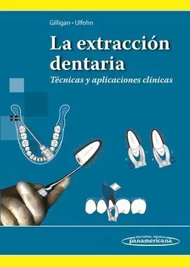 La Extracción Dentaria