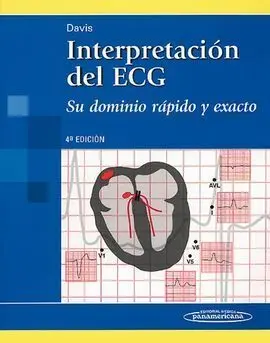 Interpretación del Ecg