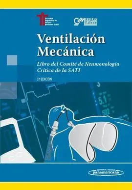 Ventilación Mecánica