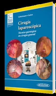 Cirugía Laparoscópica