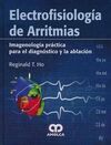 ELECTROFISIOLOGIA DE ARRITMIAS