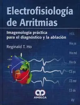 Electrofisiologia de Arritmias