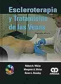 Escleroterapia y Tratamiento de las Venas