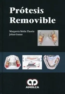 Protesis Removible