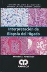 INTERPRETACIÓN DE BIOPSIA DEL HIGADO
