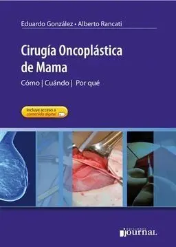 Cirugia Oncoplastica de Mama. Como - Cuando - por que (Incluye Acceso Online)