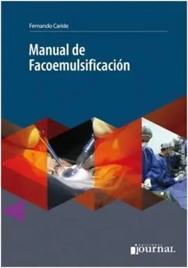 Manual de Facoemulsificacion + Acceso Online